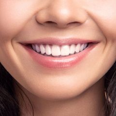 5 Tips for Keeping Your Teeth White after a Whitening Treatment-3669364a