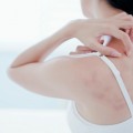 The-Best-Organic-Soap-for-People-with-Eczema-bf47c57a
