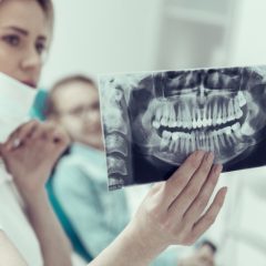 5 Tooth Fractures Facts You’re Probably Unaware Of-50912139