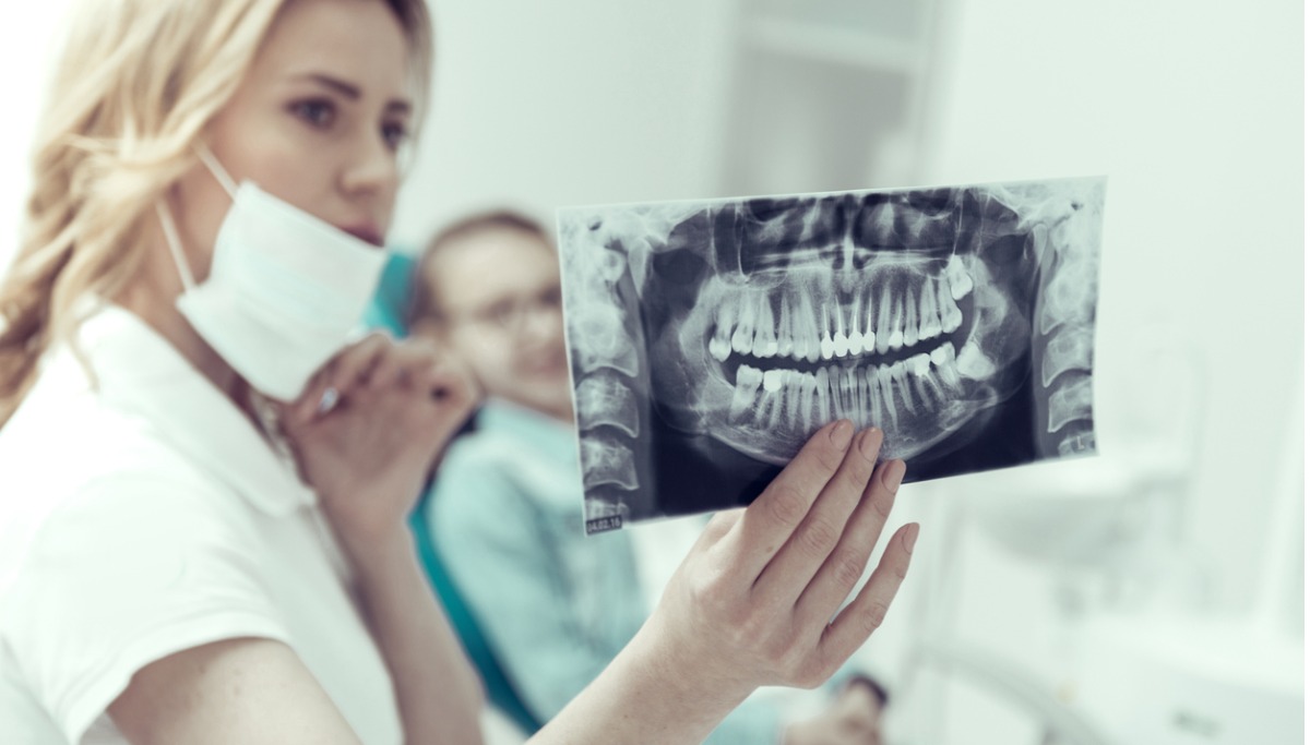 5 Tooth Fractures Facts You’re Probably Unaware Of-50912139