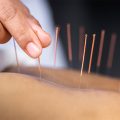 Everything You Should Know About Acupuncture for Plantar Fasciitis-6beba3ad