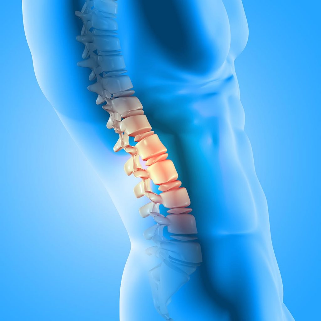 Everything You Should Know About Degenerative Disc Disease-a76a7d8d