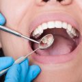 7 Oral Issues That Can Be Caused by Poor Oral Hygiene-47217974