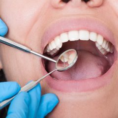 7 Oral Issues That Can Be Caused by Poor Oral Hygiene-47217974