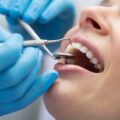 Top 8 Cosmetic Dentistry Myths