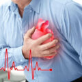 Innovations in Heart Attack Treatment_ A Comprehensive Guide