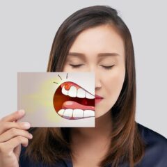 Top 6 Hereditary Dental Problems You Should Be Aware Of