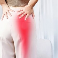 8 Must-Know Sciatica Facts