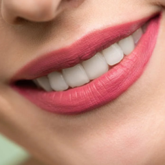 How Many Times Do You Need to Bleach Your Teeth