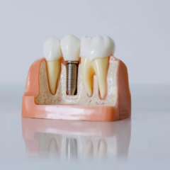 Dental Implant Options For Patients With a Significant Bone Loss