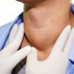 8 Practical Steps to Reduce Your Risk of Head and Neck Cancer