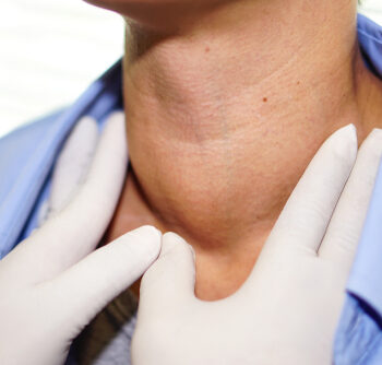 8 Practical Steps to Reduce Your Risk of Head and Neck Cancer