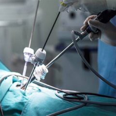 Laparoscopic Hernia Surgery_ A Modern Treatment Method