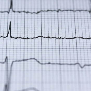 What Is Nuclear Stress Testing