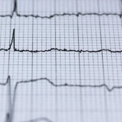 What Is Nuclear Stress Testing