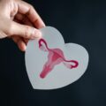 PCOS management